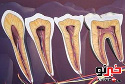 مرض زونا گاهی اوقات به صورت دندان درد بروز خواهد کرد 1