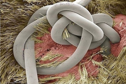 بخیه پوست انسان در زیر میکروسکوپ