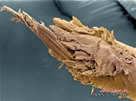 موی شکسته انسان در زیر میکروسکوپ