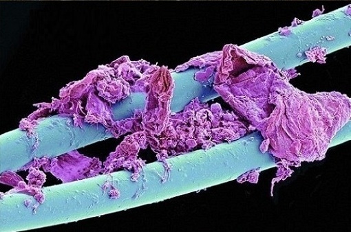 نخ دندان در زیر میکروسکوپ