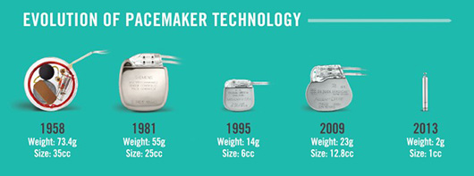 Evolution of Pacemaker Technology