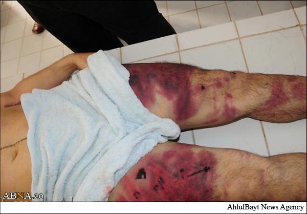 وضعیت در بحرین غیرقابل تحمل است +تصاویر دردناک
