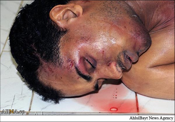 وضعیت در بحرین غیرقابل تحمل است +تصاویر دردناک