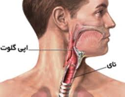 اپی گلوت